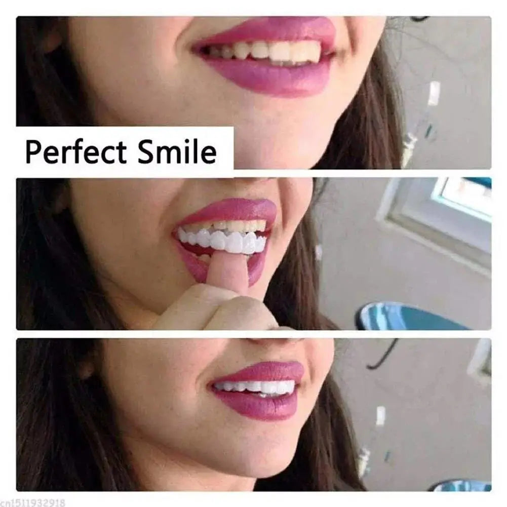 newly Veneer Snap-on Teeth Kit Fake Temporary Tooth Whitening Replacement Temporary Tooth Replacement Men Women BHL1110-cat