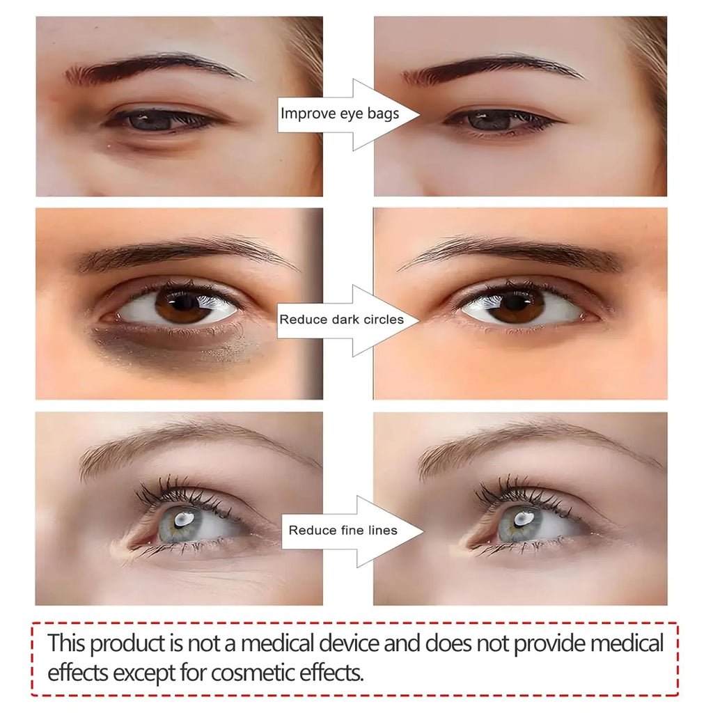 3D Eye Beauty Instrument Micro-Current Pulse Eye Relax Reduce Wrinkles and Dark Circle Remove Eye Bags Massager Beauty Tool