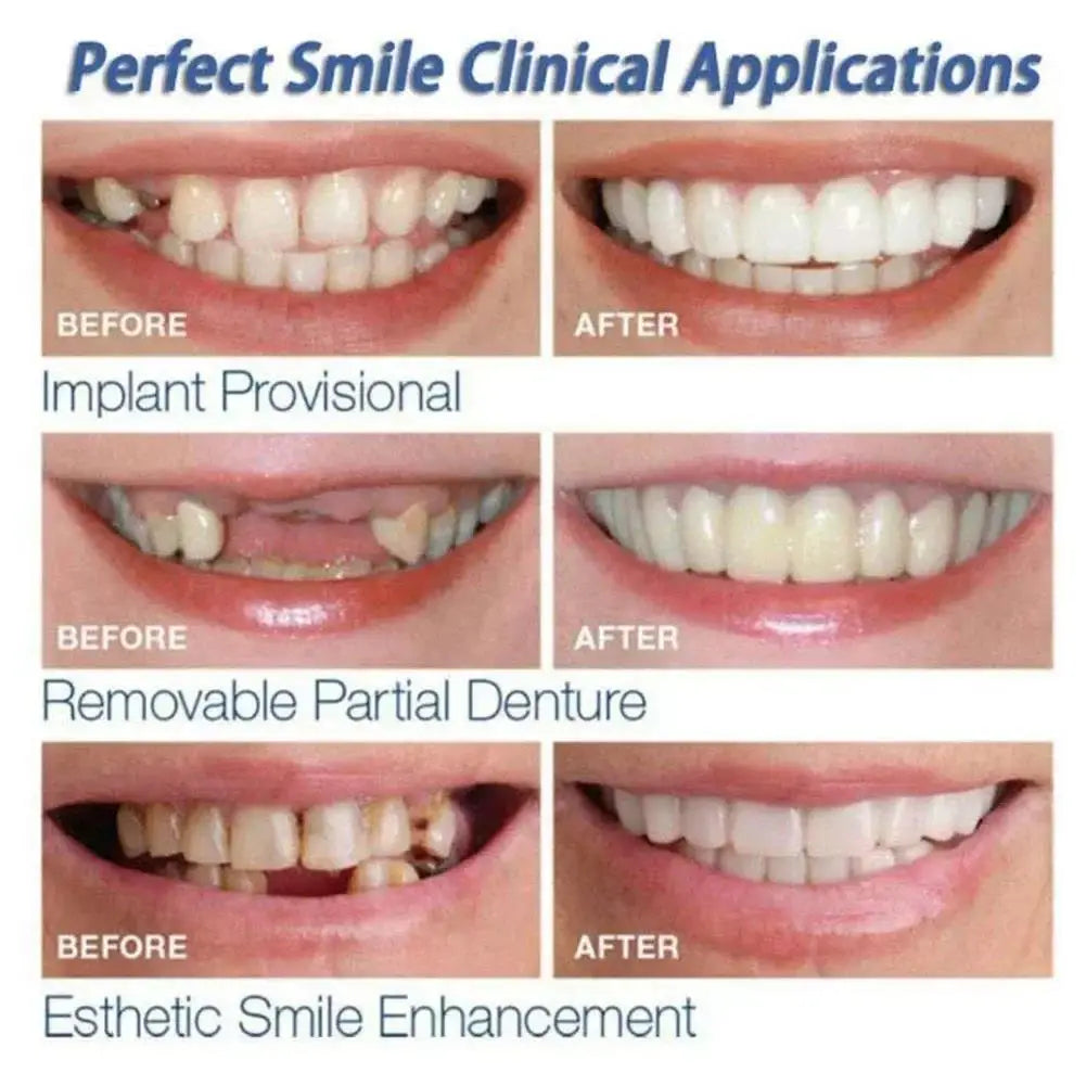 newly Veneer Snap-on Teeth Kit Fake Temporary Tooth Whitening Replacement Temporary Tooth Replacement Men Women BHL1110-cat