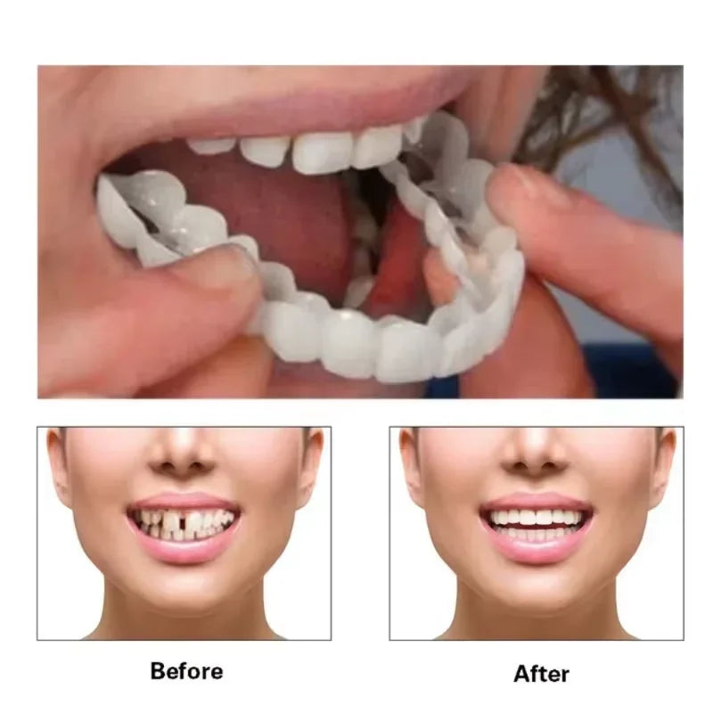 newly Veneer Snap-on Teeth Kit Fake Temporary Tooth Whitening Replacement Temporary Tooth Replacement Men Women BHL1110-cat