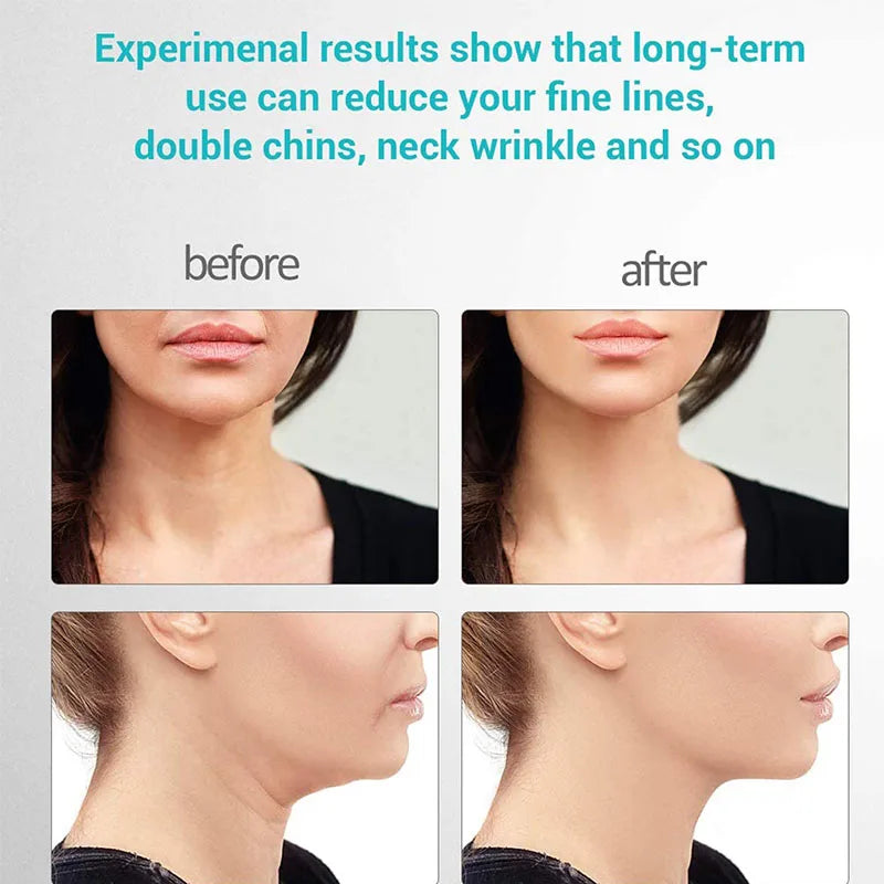 Anti-Aging Face Lifting Device with Therapy Reduce Wrinkle Skin Tightening Rejuvenation Neck Lifting Massager